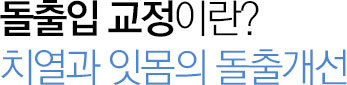 돌출입 교정이란?