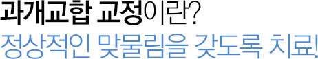 과개교합 교정이란?