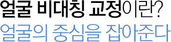 얼굴비대칭 교정이란?