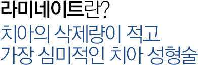 라미네이트란?