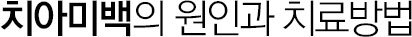 치아미백 원인과 치료방법