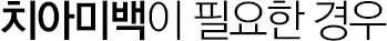 치아미백이 필요한 경우