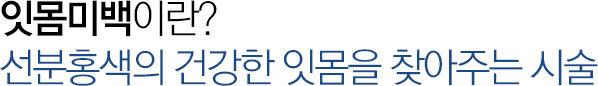 잇몸미백이란?
