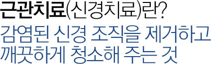 근관치료?