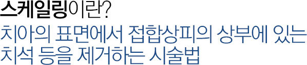 스케일링?